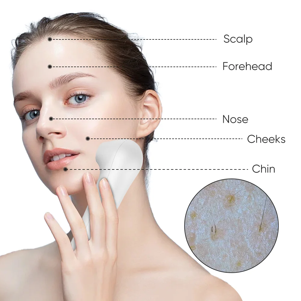 Escáner facial dermatología HD - Hair Care Homemade reseña y precio
